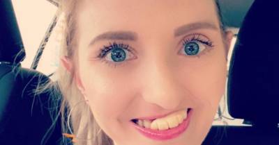 28-летняя девушка лишилась зубов из-за запущенного рака — но продолжает улыбаться - wmj.ru - Сша - штат Калифорния - Лос-Анджелес