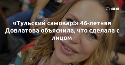 Алла Довлатова - «Тульский самовар!» 46-летняя Довлатова объяснила, что сделала с лицом - 7days.ru