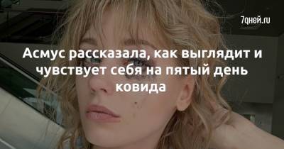 Кристина Асмус - Гарик Харламов - Асмус рассказала, как выглядит и чувствует себя на пятый день ковида - 7days.ru