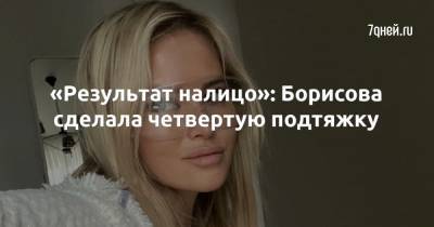 Дан Борисов - «Результат налицо»: Борисова сделала четвертую подтяжку - 7days.ru