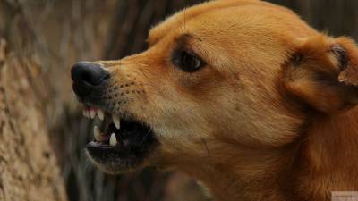 Бездомная собака прокусила лицо десятилетней девочке в Ангарске - mur.tv - Ангарск