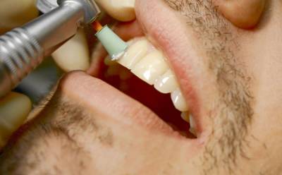 Почему профессиональная гигиеническая чистка зубов улучшает общее состояние вашего здоровья - news.yellmed.ru - Англия