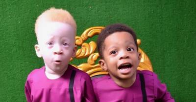 Близнец темнокожего малыша оказался рыжим альбиносом — как выглядят необычные братья - wmj.ru