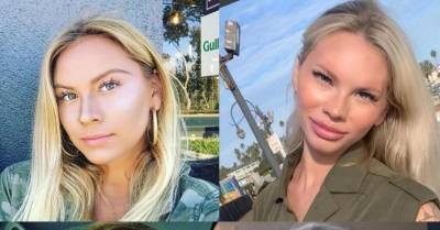 До и после: симпатичная блондинка стала неузнаваемой после неудачной инъекции филлеров - wmj.ru - штат Калифорния