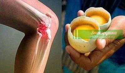 Как использовать 2 яйца для полного исчезновения боли в колени и «ремонта» суставов - lublusebya.ru