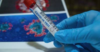 ПЦР тест для определения гриппа и COVID-19: разработка украинских учёных - womo.ua