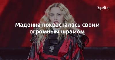 Эшли Грэм - принцесса Беатрис - Мадонна похвасталась своим огромным шрамом - 7days.ru
