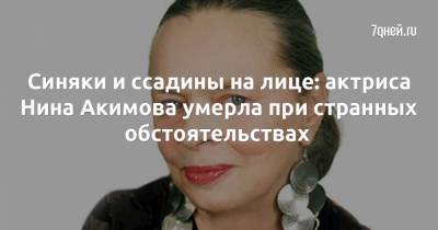 Синяки и ссадины на лице: актриса Нина Акимова умерла при странных обстоятельствах - 7days.ru