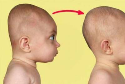 4 хитрости помогут предотвратить синдром плоской головы у младенца - lublusebya.ru
