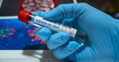 Украина закупит 2 млн доз китайской вакцины от COVID-19 - womo.ua - Китай - Сша - Украина - Швейцария - Австралия - Англия - Япония
