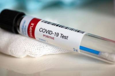 Положено ли лечение от коронавируса бесплатно? И другие виды бесплатной медицинской помощи, о которых вы должны знать - milayaya.ru - Россия