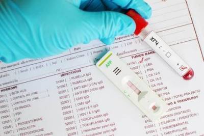 Что такое анализ крови на ХГЧ и как к нему подготовиться - lifehelper.one