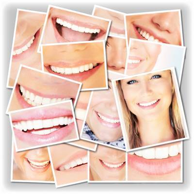 «Какие виды отбеливания зубов лучше и безопаснее?» - lublusebya.ru