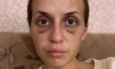 «Сын просит прощения, что не защитил»: жестоко избитая в поезде украинская телеведущая так и не восстановилась, а ее 6-летнему ребенку нужен психолог - woman.ru - Киев - Мариуполь