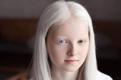 Чеченка-альбинос с гетерохромией стала звездой Сети - woman.rambler.ru - Сша - республика Чечня