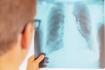 Как провести диагностику на туберкулез? - lifehelper.one