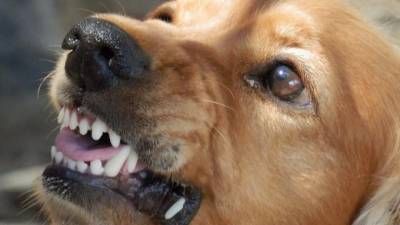 В Находке стая собак напала на 8-летнюю девочку - mur.tv - Мексика - Приморье край