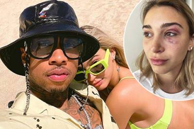 Kylie Jenner - Экс-бойфренда Кайли Дженнер рэпера Tyga обвинили в домашнем насилии - spletnik.ru - Сша