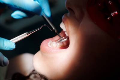 12 вопросов стоматологу-ортопеду: какое протезирование лучше выбрать. - news.yellmed.ru