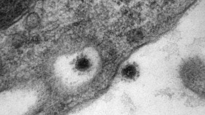Как выглядит дельта-штамм коронавируса - porosenka.net - Китай - Россия - Индия