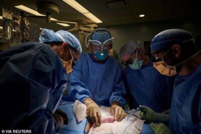 Хирурги впервые успешно пересадили почку свиньи человеку - chert-poberi.ru - Сша - Нью-Йорк - Нью-Йорк