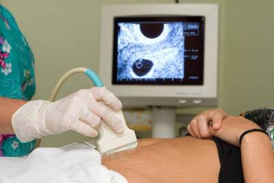 Опасна ли внематочная беременность и каковы ее причины? - lifehelper.one