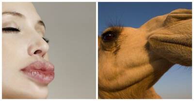 Более 40 верблюдов сняли с конкурса красоты из-за злоупотребления ботоксом - porosenka.net - Саудовская Аравия