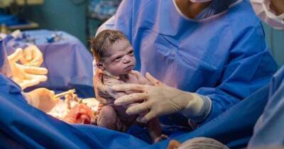 Добро пожаловать в наш мир! Уморительное выражение лица только что новорождённой малышки разлетелось по всему Интернету - cpykami.ru - Рио-Де-Жанейро