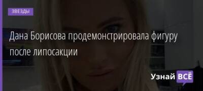 Дана Борисова - Дана Борисова продемонстрировала фигуру после липосакции - uznayvse.ru