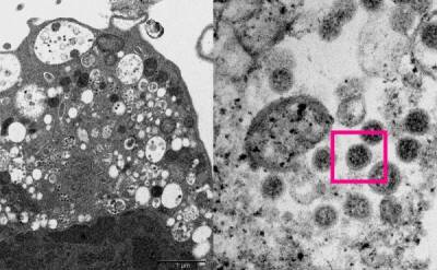 Ученые опубликовали фотографии вируса «Омикрон» - porosenka.net - Юар - Ботсвана - Гонконг - Гонконг