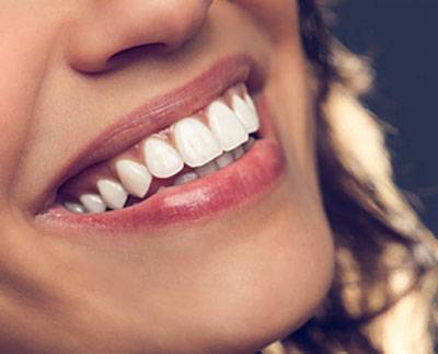 Как быстро отбелить зубы дома: 3 способа от известного стоматолога - inmoment.ru