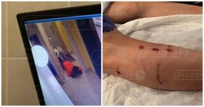 Нападение питбуля на школьника в подъезде дома в Новосибирске - porosenka.net - Россия - Новосибирск