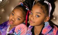 9-летние близняшки прославились из-за генетической мутации: фото - wday.ru