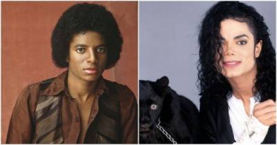 Майкл Джексон - Кардинальная перемена во внешности Майкла Джексона кроется в витилиго - porosenka.net