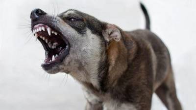 Собака искусала лицо 5-летнему мальчику под Новосибирском - mur.tv - Новосибирск - Новосибирская обл. - Бердск