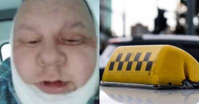 Барнаульский таксист выжил благодаря второму подбородку после того, как неизвестные перерезали ему горло - porosenka.net