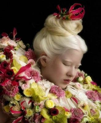 Брошенная в младенчестве из-за альбинизма Сюэли выросла, чтобы стать моделью Vogue - chert-poberi.ru - Китай - Голландия