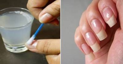 ​Как сделать сделать ногти белыми и крепкими - lifehelper.one