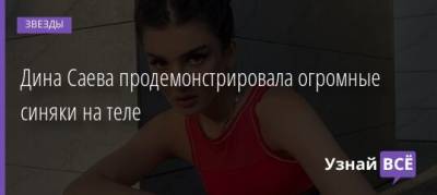 Дина Саева - Дина Саева продемонстрировала огромные синяки на теле - uznayvse.ru - Россия