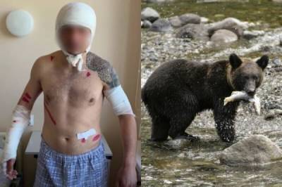 "Больше никаких рыбалок!": после встречи с медведем сахалинец выжил, оставшись без части скальпа - porosenka.net