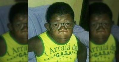 В Анголе обнаружили мальчика, который "родился от человека и шимпанзе" - porosenka.net - Ангола