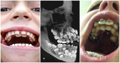 Пугающие факты о человеческом теле: как возникает аномалия зубов - porosenka.net - Индия