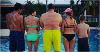 15 человек, которые узнали, как правильно работает солнцезащитный спрей самым болезненным способов - cpykami.ru - штат Флорида
