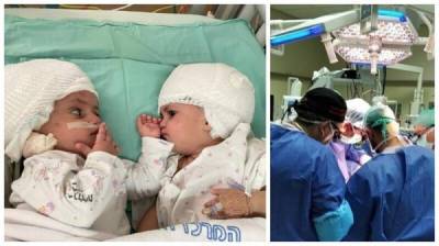 В Израиле провели уникальную операцию по разделению сиамских близнецов - porosenka.net - Израиль - Лондон