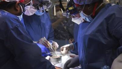 Ученые в США впервые пересадили свиное сердце человеку - womo.ua - Сша - штат Мэриленд