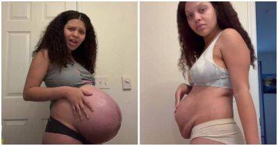 Мама 4-х детей решилась показать, как на самом деле выглядит тело женщины после родов - lifehelper.one