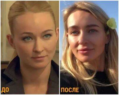 Знаменитые девушки, которые потеряли индивидуальность увеличив губы - lublusebya.ru