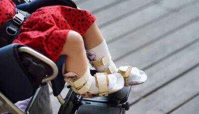 В Україні діти з інвалідністю у 3,6 разів частіше страждають від фізичного насильства, ніж їх однолітки - womo.ua