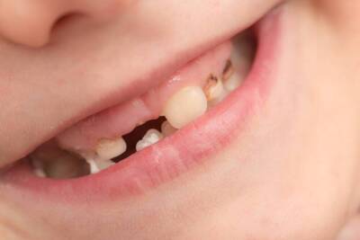 Что нужно знать о детских зубах? - lifehelper.one
