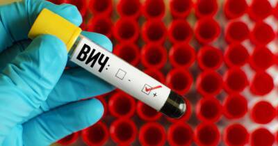 Он убивает быстрее: ученые в Нидерландах обнаружили новый штамм ВИЧ - womo.ua - Голландия